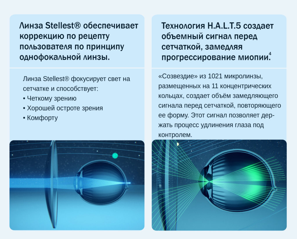 Линзы стеллест очковые отзывы. Stellest линзы очковые. Линзы Stellest разметка. Stellest линзы очковые принцип действия. Лечебные линзы для детей.